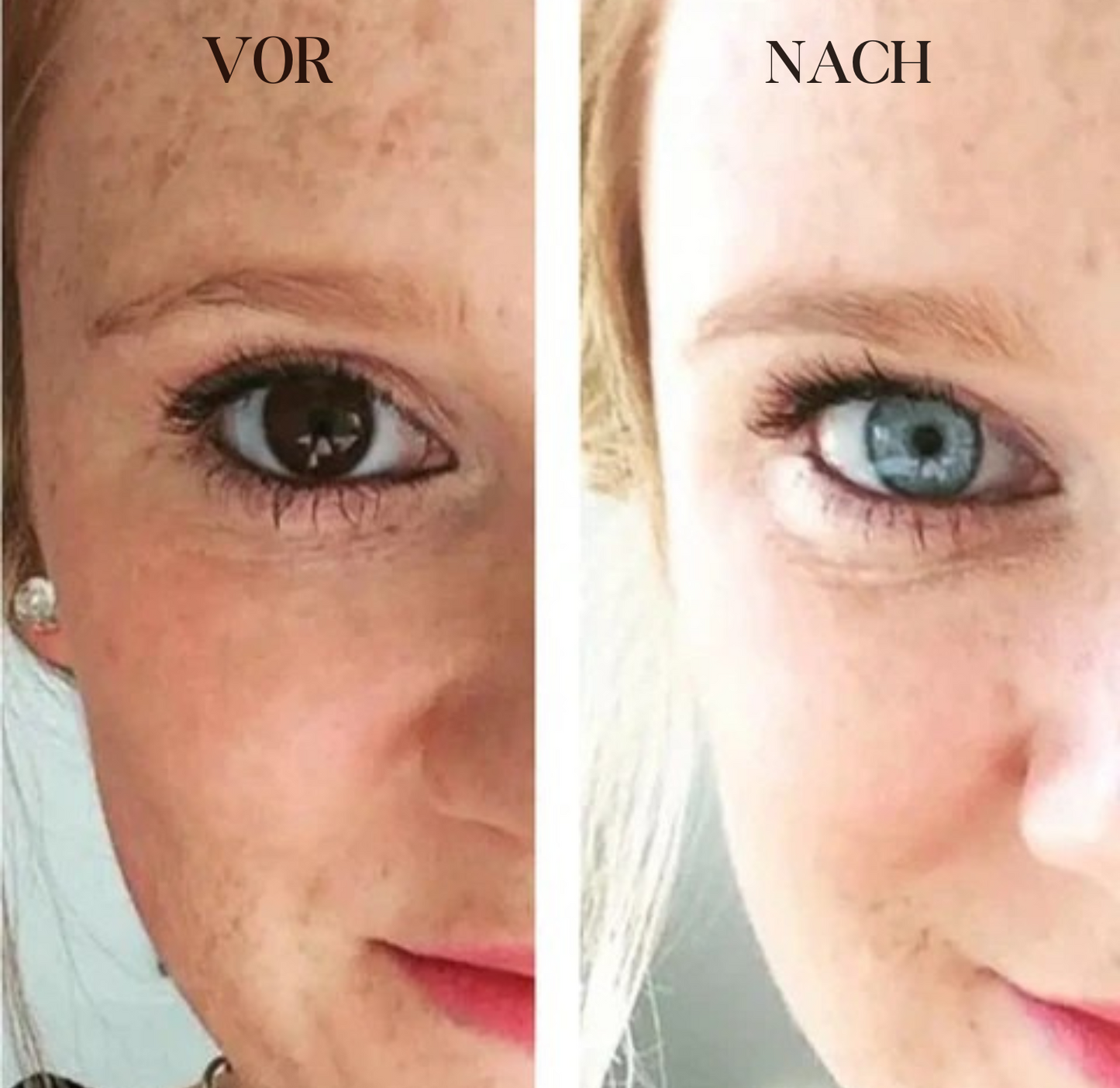 1+1 Kostenlos | IriGlow™ Farbwechselnde Augentropfen für einen einzigartigen Look