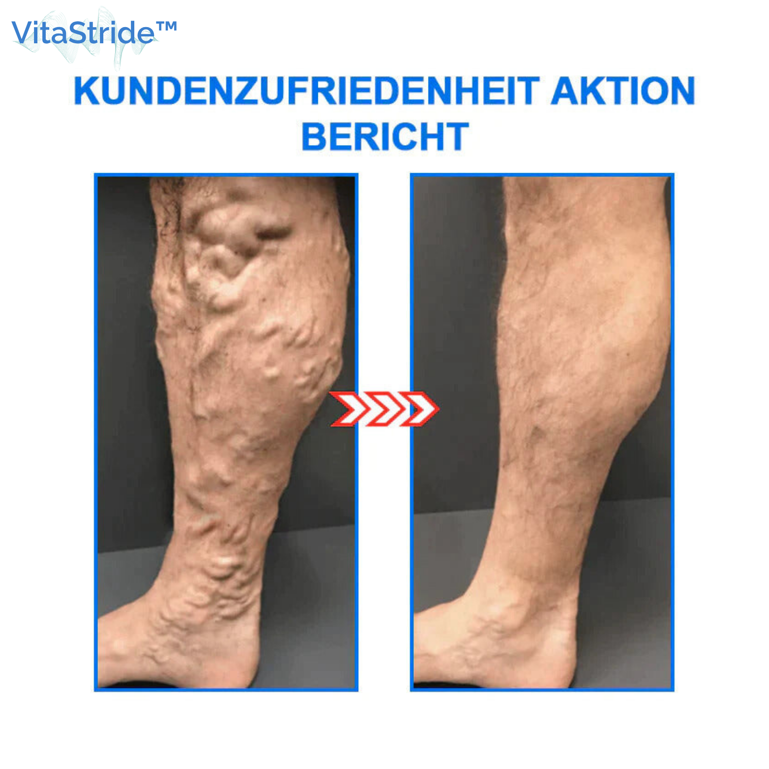 VitaStride™ Ionen-Kompressionssocken mit Tomalin
