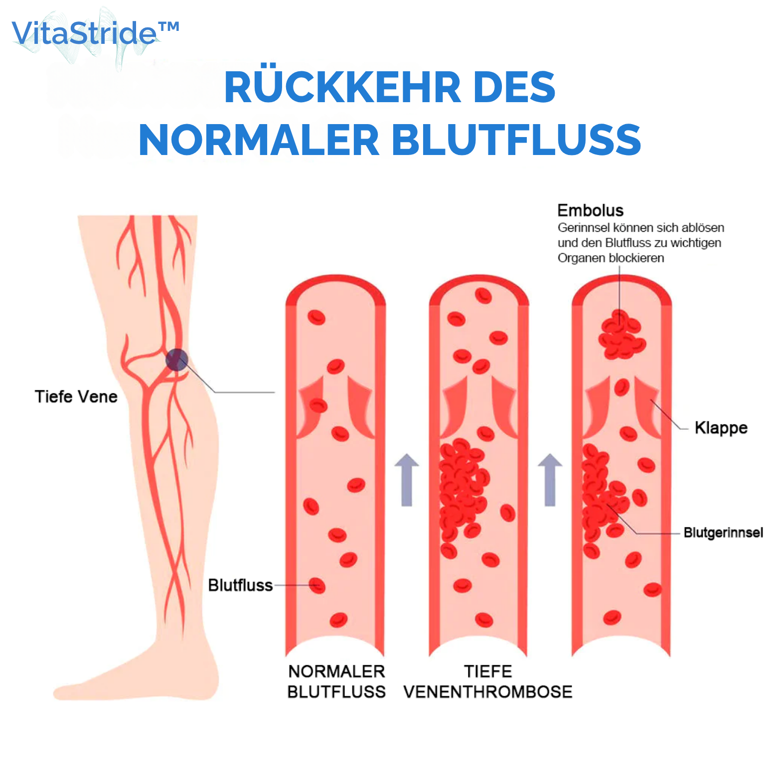 VitaStride™ Ionen-Kompressionssocken mit Tomalin